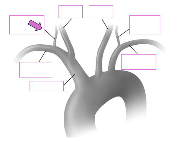<p>Based on the indicated area, identify this vessel</p>