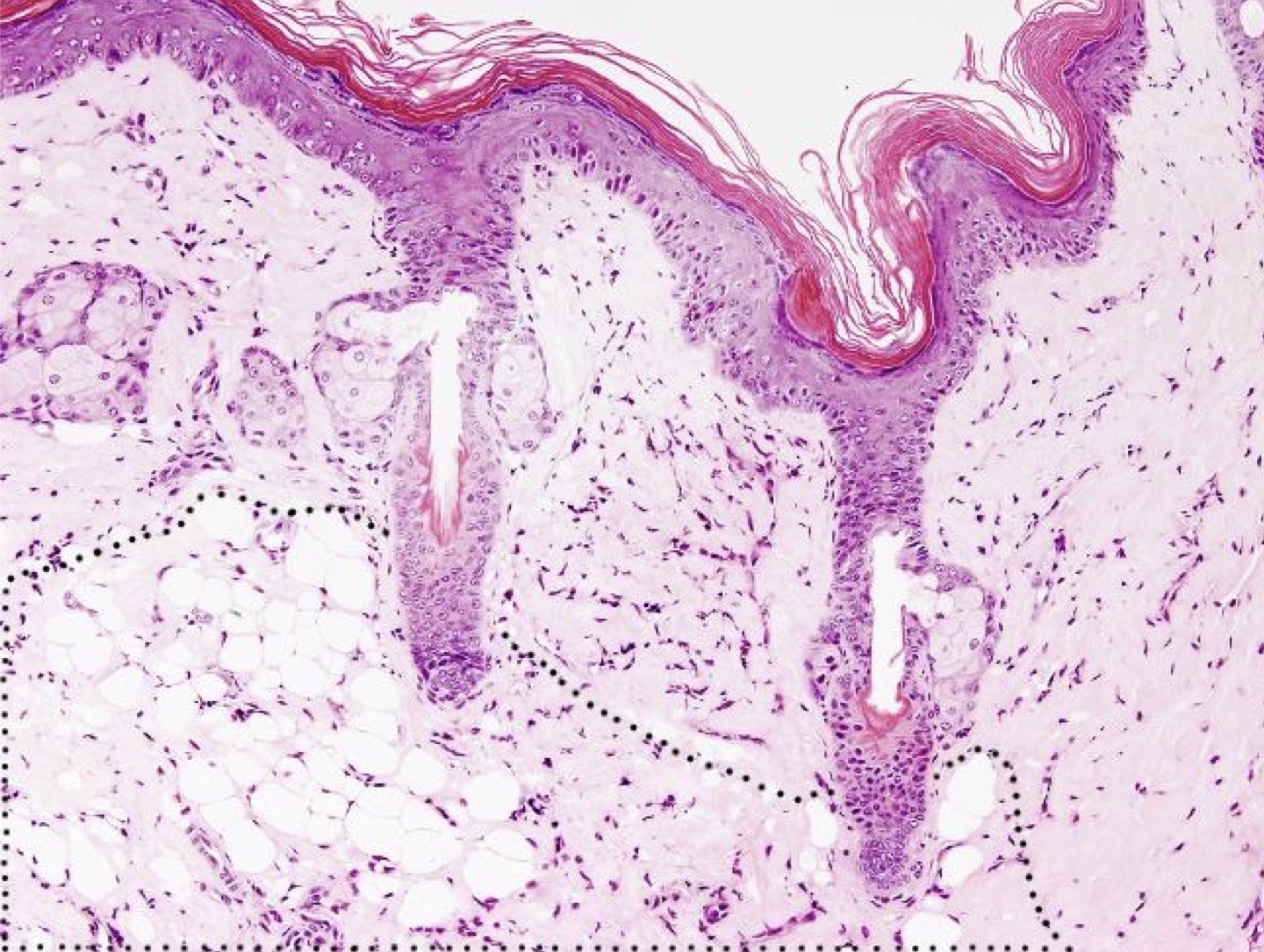 <p>Identify the layer?</p>