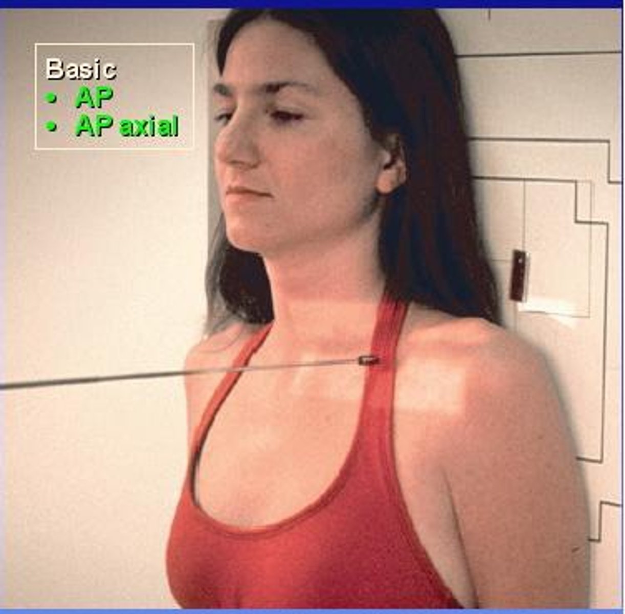 <p>S - around waist</p><p>T - 7 mAs @ 70 kVp</p><p>A - none</p><p>M - side being imaged</p><p>P - CR mid clavicle, get both joints</p><p>S - 40"</p><p>B - deep breath in, hold</p><p>C - 10 x 12 crosswise</p>