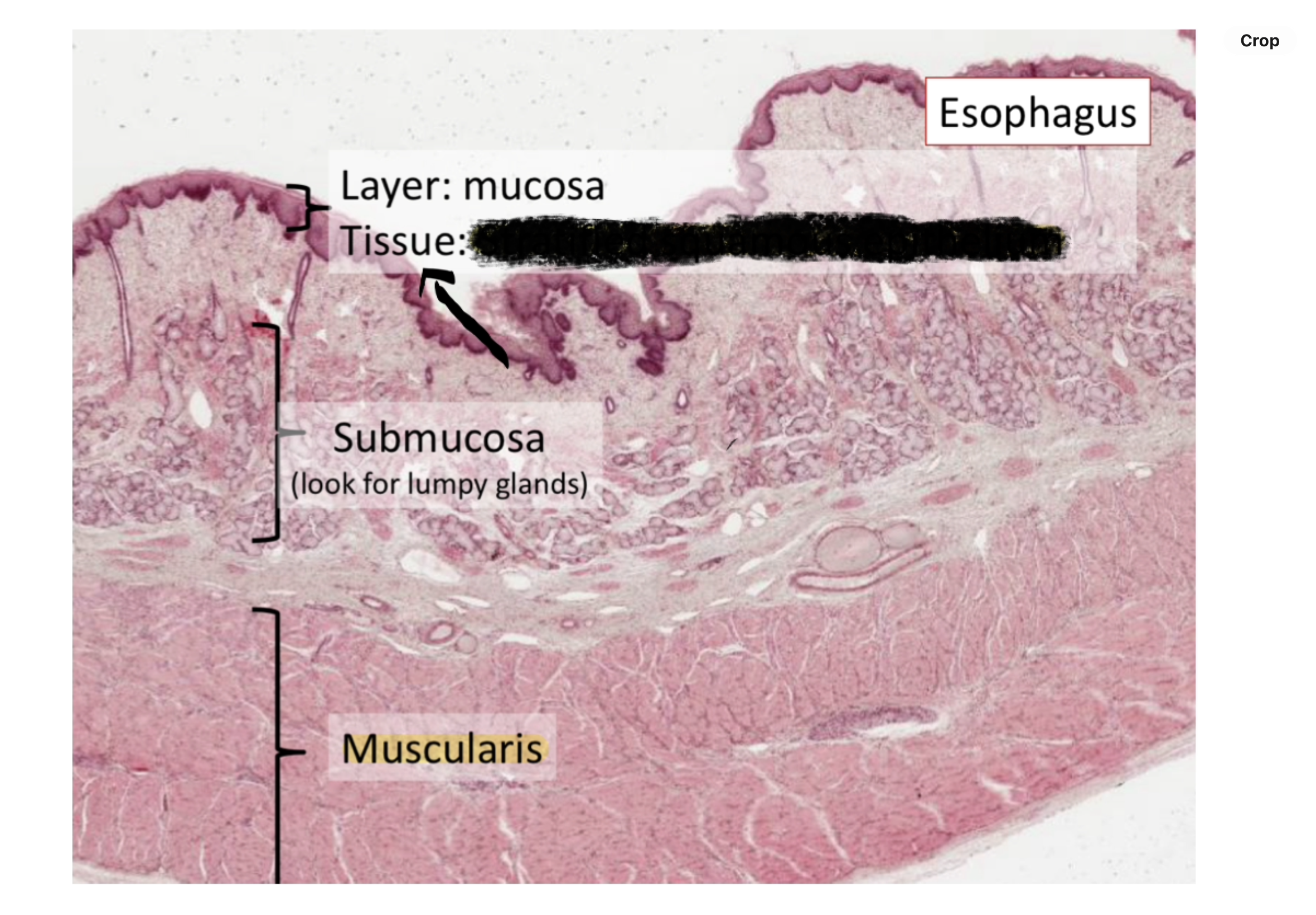 <p>Nonkeratinized stratified squamous epithelium</p>