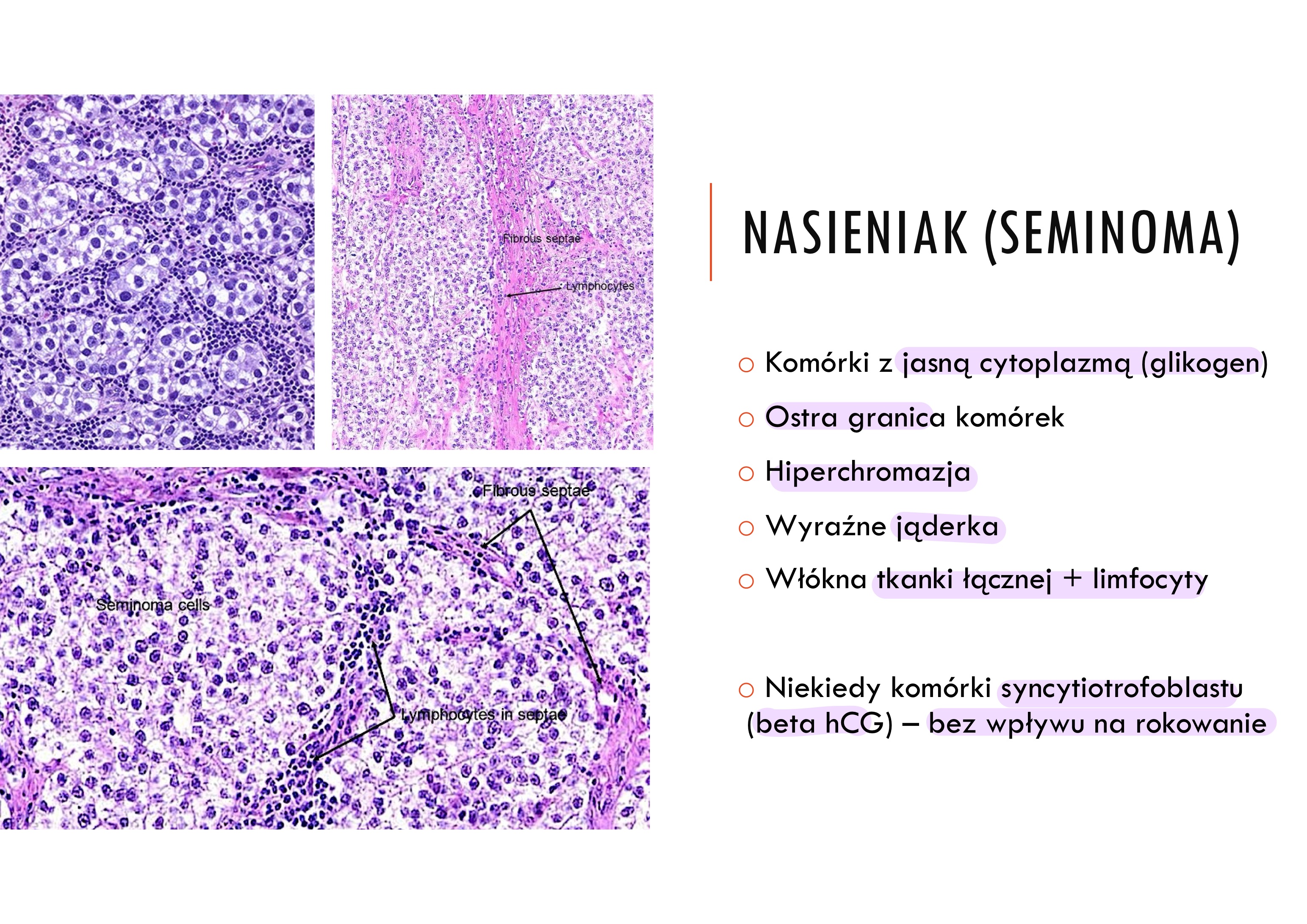 <p>bo zbiera się&nbsp;w nich glikogen</p>