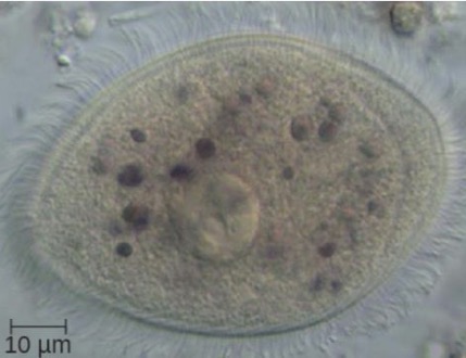 <p>Supergroup: Chromalveolata</p><ul><li><p>Only ciliate that can parasitize humans</p></li></ul><p></p>