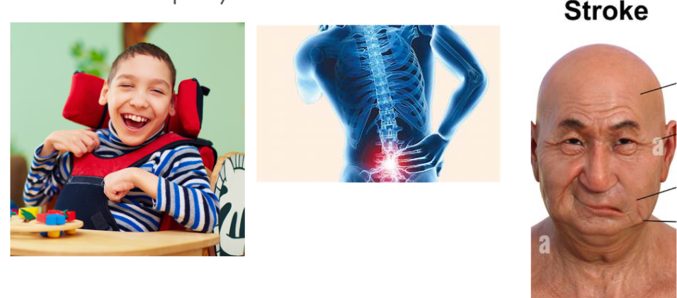 <p>What other three disorders often</p><p>present with spasticity?</p>