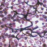 <p>CT Proper Loose:</p><p>Reticular</p>