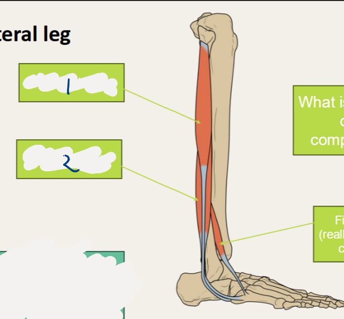 <p>LABEL lateral leg</p>