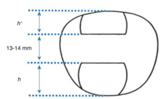 <p>When a double seg lens is ordered, the lower edge of the top segment is _____ to _____ mm above the lower seg line position.</p>