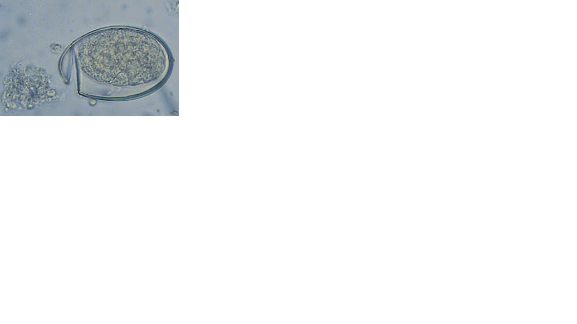 <p>Name the fluke or flatworm</p>