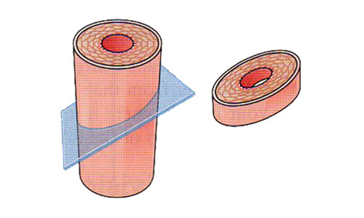 <p>cuts made diagonally between the horizontal and the vertical planes</p>