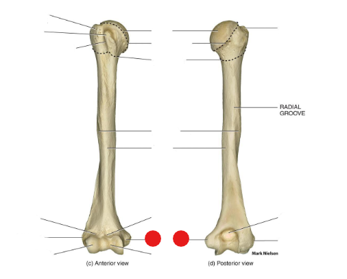 <p>Identify the structure pinned</p>
