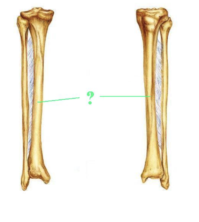 <p><span>Is the indicated bone from the right of left side of the body?</span></p>