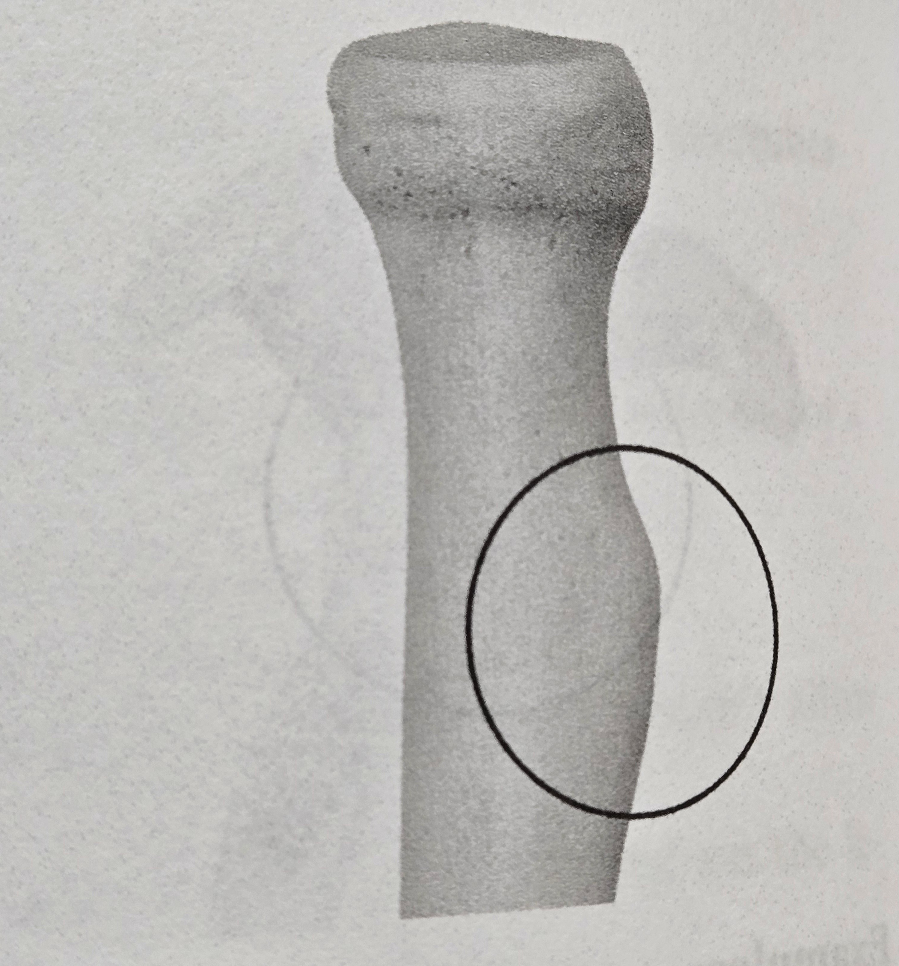 <p>Tuberosity</p>