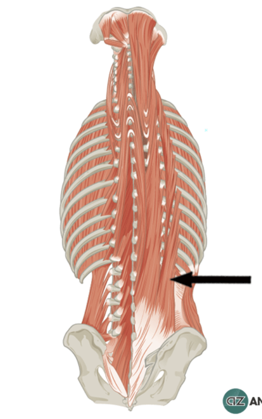 <p>Identify the highlighted muscle </p>