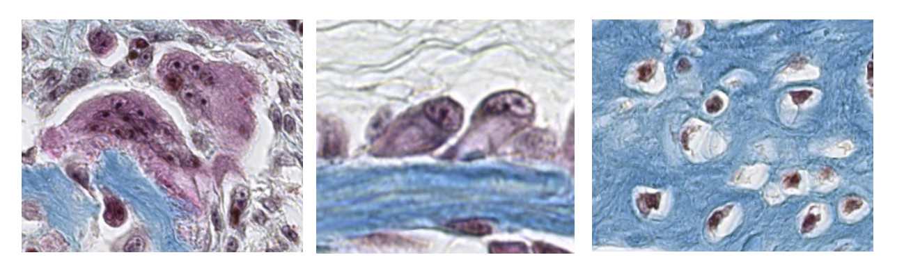 <p><span style="font-family: "Calibri Light";">This is a high-power magnification of the three basic types of bone cells: osteoblasts, osteocytes, osteoclasts.<br> <br> ID the bone cells, from left to right.</span></p>