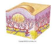 <ul><li><p>solid</p></li><li><p>palpable</p></li><li><p>1-2cm</p></li><li><p>Elevated, circumscribed </p></li><li><p>deeper than papule</p></li></ul><p></p>