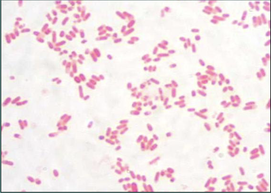 <p>what is the result of this gram stain?</p>