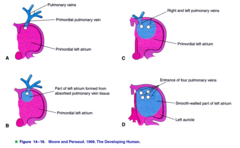 <p>a single pulmonary vein develops in the left side of the primitive atrium and branches twice to produce two right and two left pulmonary veins. Eventually pulmonary vein system undergoes intussusception into left dorsal wall of primitive atrium. these four branches are then incorporated into dorsal wall of left side of primitive atrium, completing formation of the smooth wall.</p>