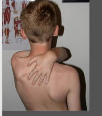 <p>reaching in front of neck to reach behind the back</p>
