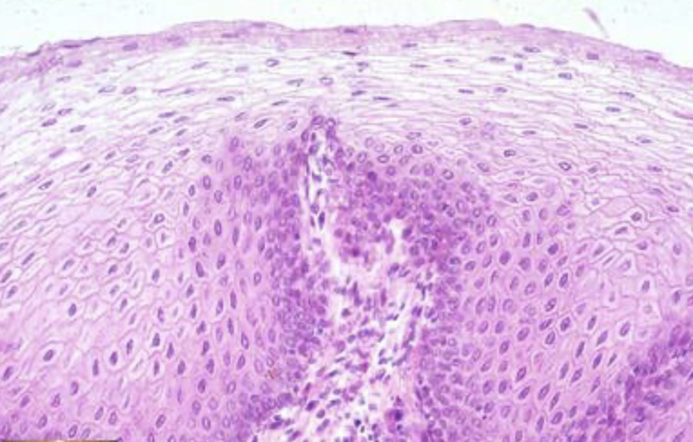 <p>tissue type </p>