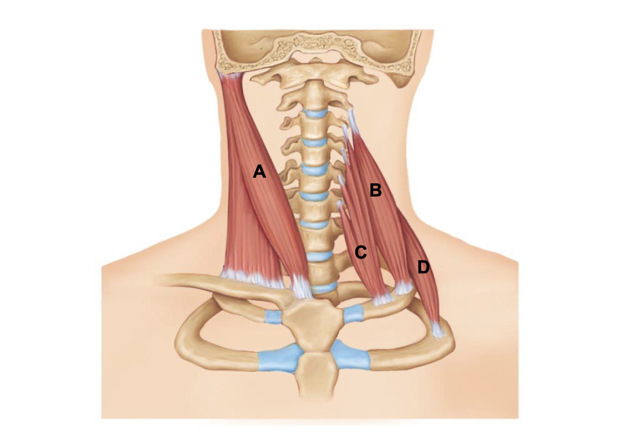 <p>A</p>