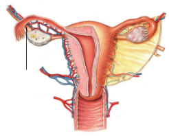 <p><span style="line-height: 17.375px;">Identify the ligament&nbsp;</span></p>