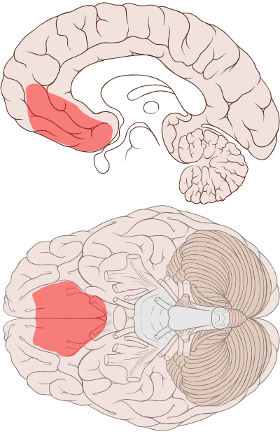 <ul><li><p>often due to an anterior communicating artery aneurysm </p></li><li><p>brain tumor within vmPFC </p></li><li><p>Phineas Gage </p></li></ul><p></p>