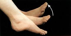 <p>Movement of the foot that points toes up, towards the shin</p>