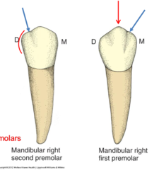 <p>Is the PKT notch located mesial or distal on the mandibular first premolar?</p>