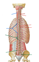 <p>What group of back muscles is pointed to in red?</p>