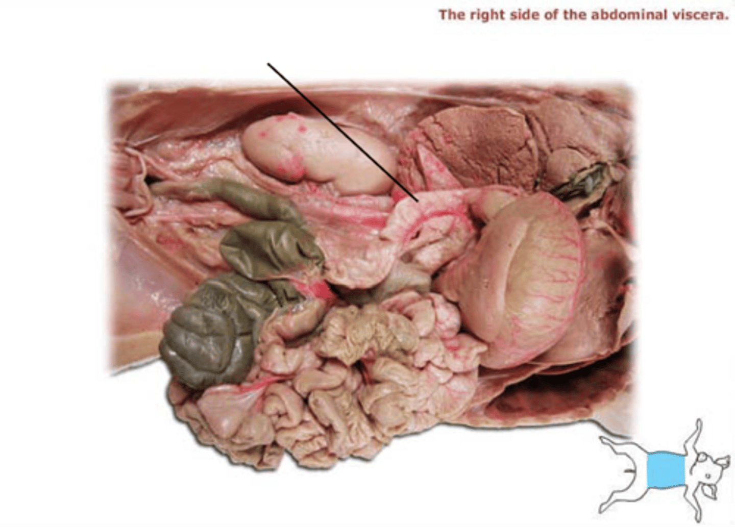 <p>first part of the small intestine</p>