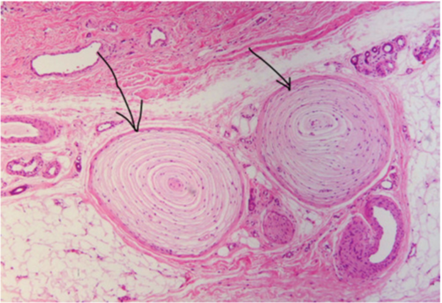 <p>Identify the structure</p>