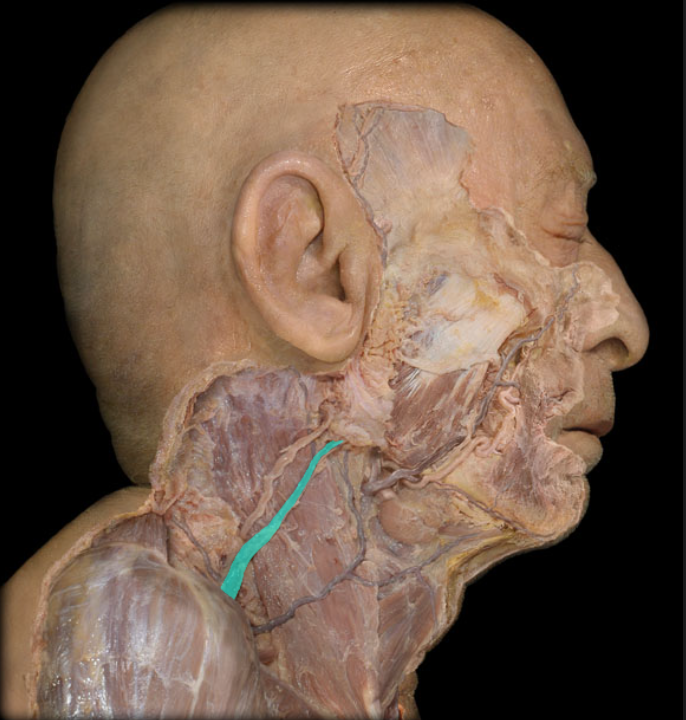 <ul><li><p><strong>Drainage: </strong>Scalp and Face</p></li><li><p><strong>Course:</strong></p><ul><li><p>Subcutaneous vessel formed by union of retromandibular and posterior auricular veins near angle of mandible</p></li><li><p>Descends toward middle of clavicle</p></li><li><p>Crosses anterior surface of sternocleidomastoid muscle</p></li></ul></li><li><p><strong>Tributaries: </strong>Retromandibular, Posterior auricular, Transverse cervical, Suprascapular, and Anterior jugula</p></li><li><p><strong>Termination: </strong>Subclavian</p></li><li><p><strong>Comment:</strong></p><ul><li><p>Often communicates with internal jugular vein (near parotid gland)</p></li><li><p>Valves present at inferior end</p></li></ul></li></ul><p></p>