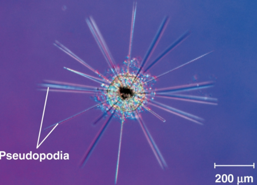 <p>Radiolarian</p>