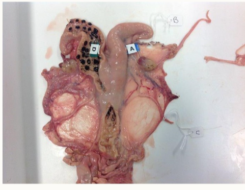 <p>what is special about the venous return in this speices?</p>