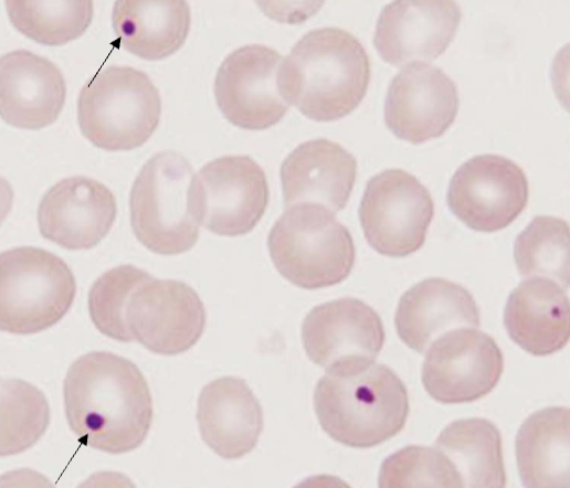 <p>name the type of RBC inclusion</p>