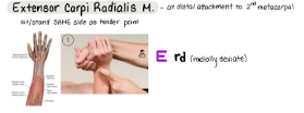 <p>E rd</p>