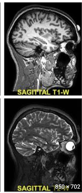 <p>From one side of the body to the other</p>