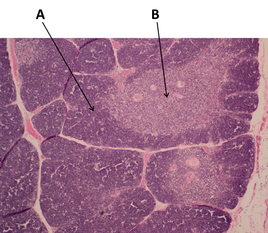 <p><span>Identify the area labeled with the letter A.</span></p>