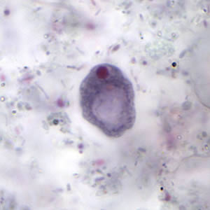 <p>- 5-20 um, single nucleus</p><p>- One large glycogen vacuole</p>