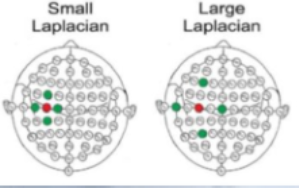 <p>How does a Laplacian Montage work?</p>