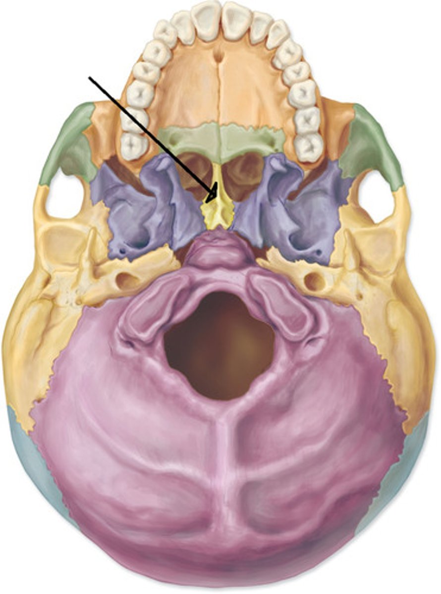 <p>ID bone at arrow</p>