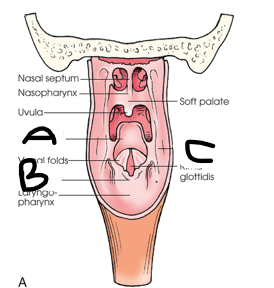 <p>what is B?</p>