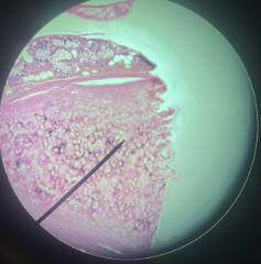 <p>Location: Nose and Ears</p><p>Function: <span style="background-color: transparent;">provides flexible, springy support to body structures that undergo frequent bending and distortion</span></p><p><span style="background-color: transparent;">Connective Tissue</span></p>