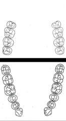<p>What kennedy classification?</p>