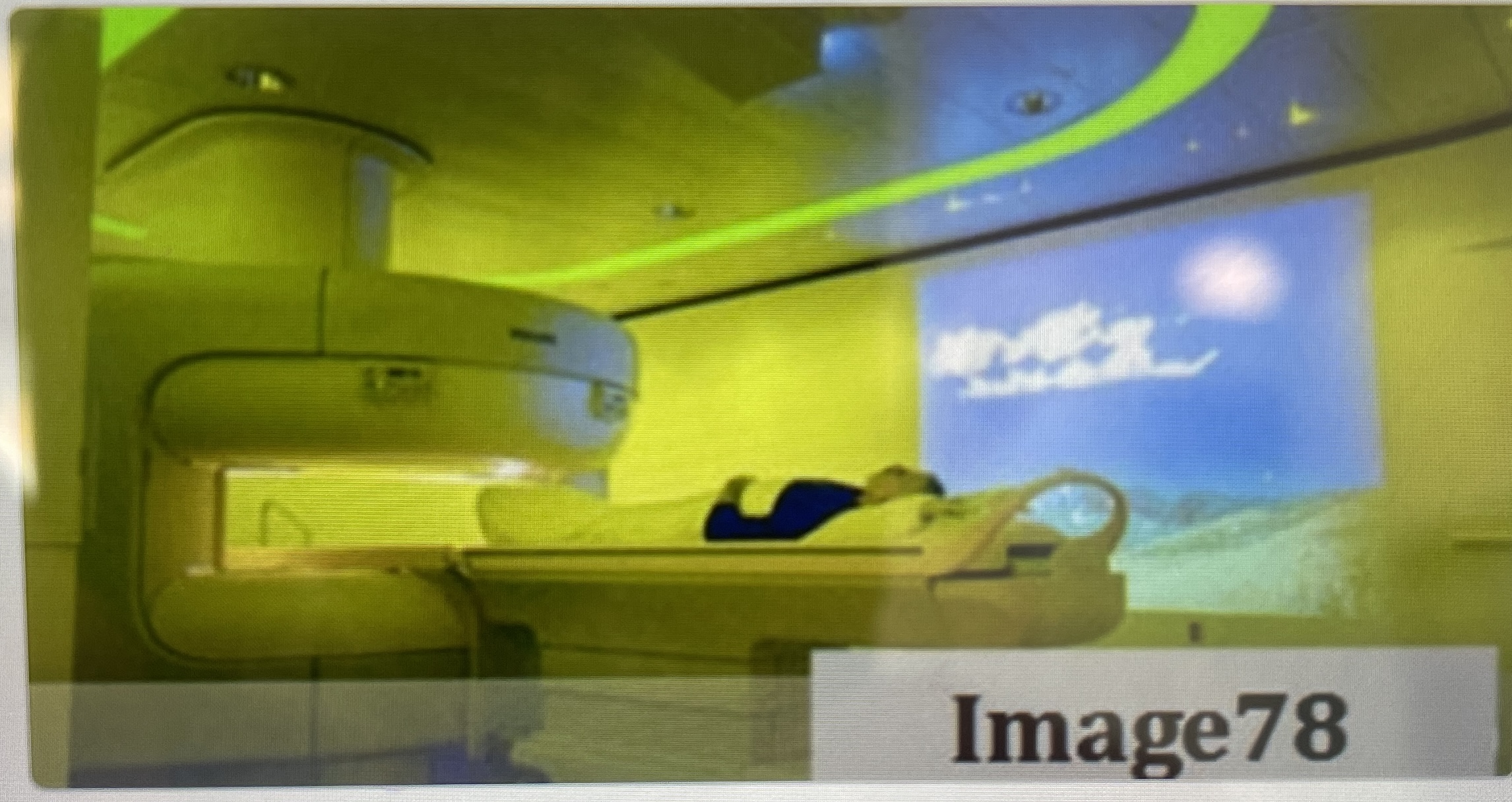 <p>What type of MR scanner?</p>