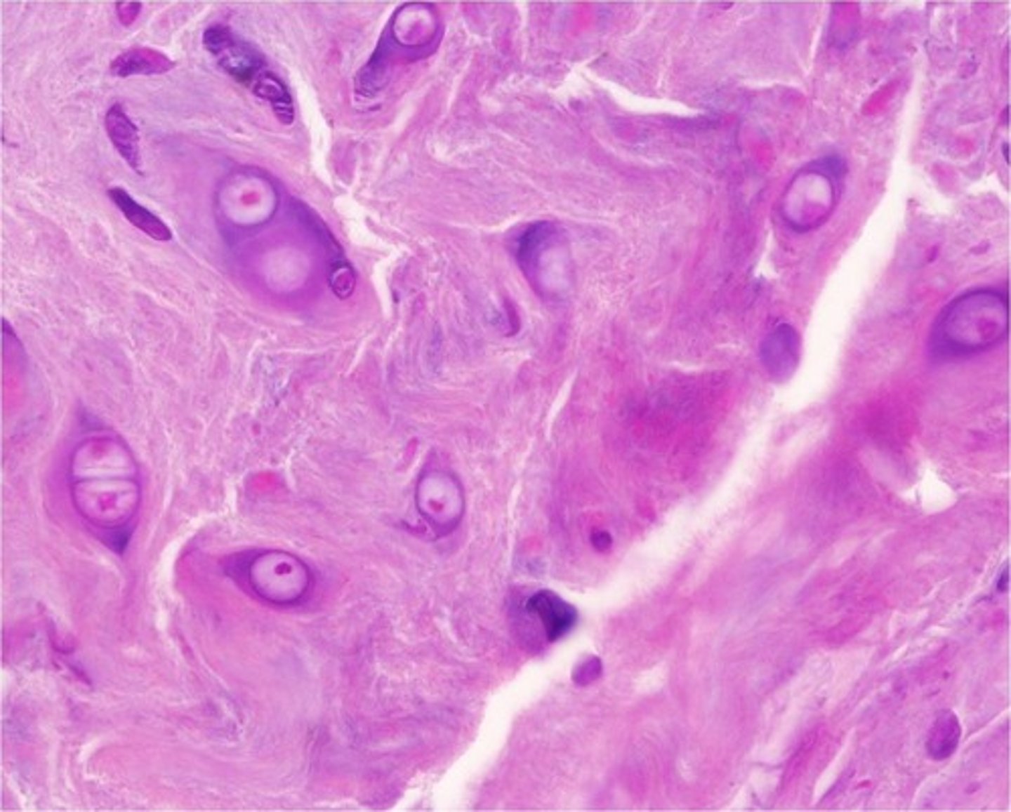 <p>Thick collagen fibers; resists compression; intervertebral discs, pubic symphysis, menisci.</p>