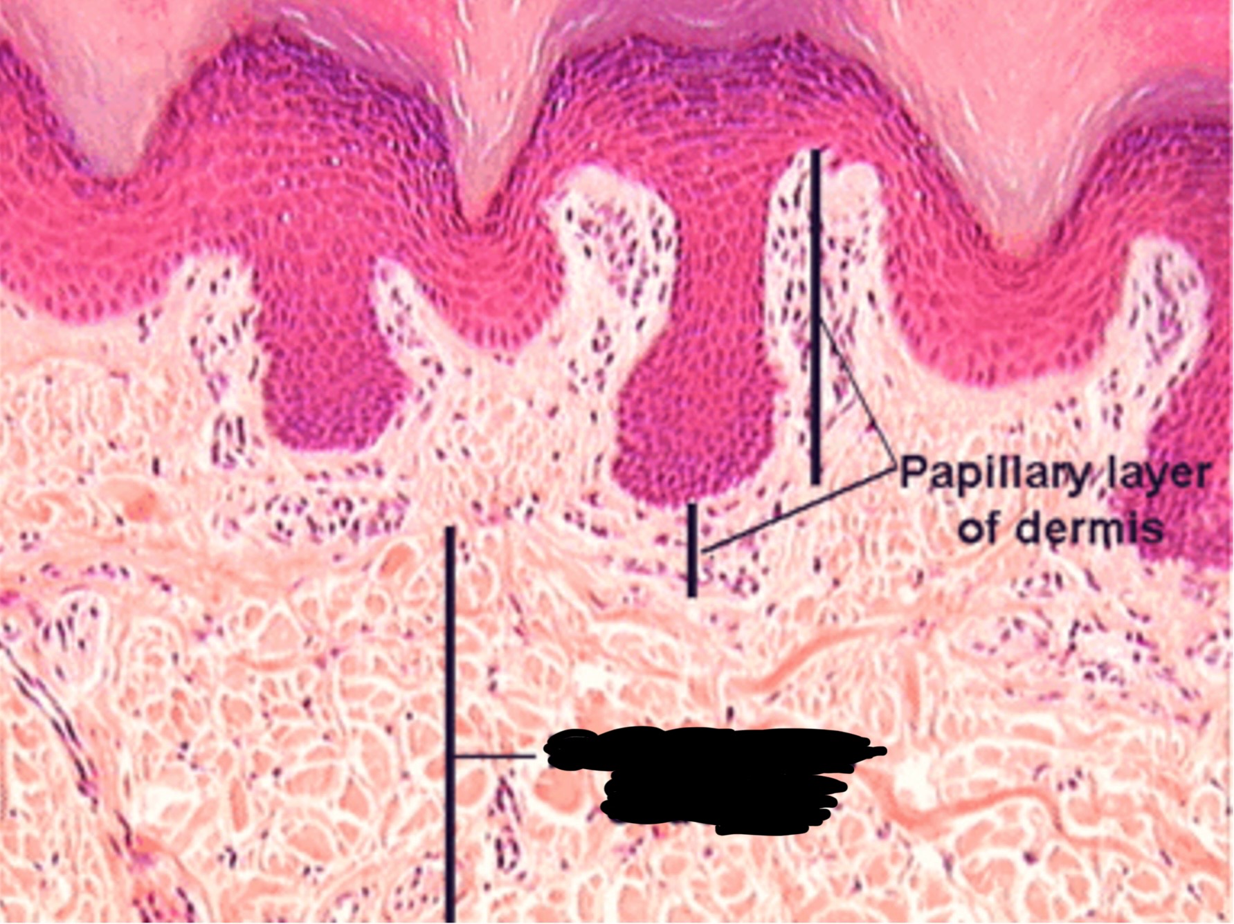 term image