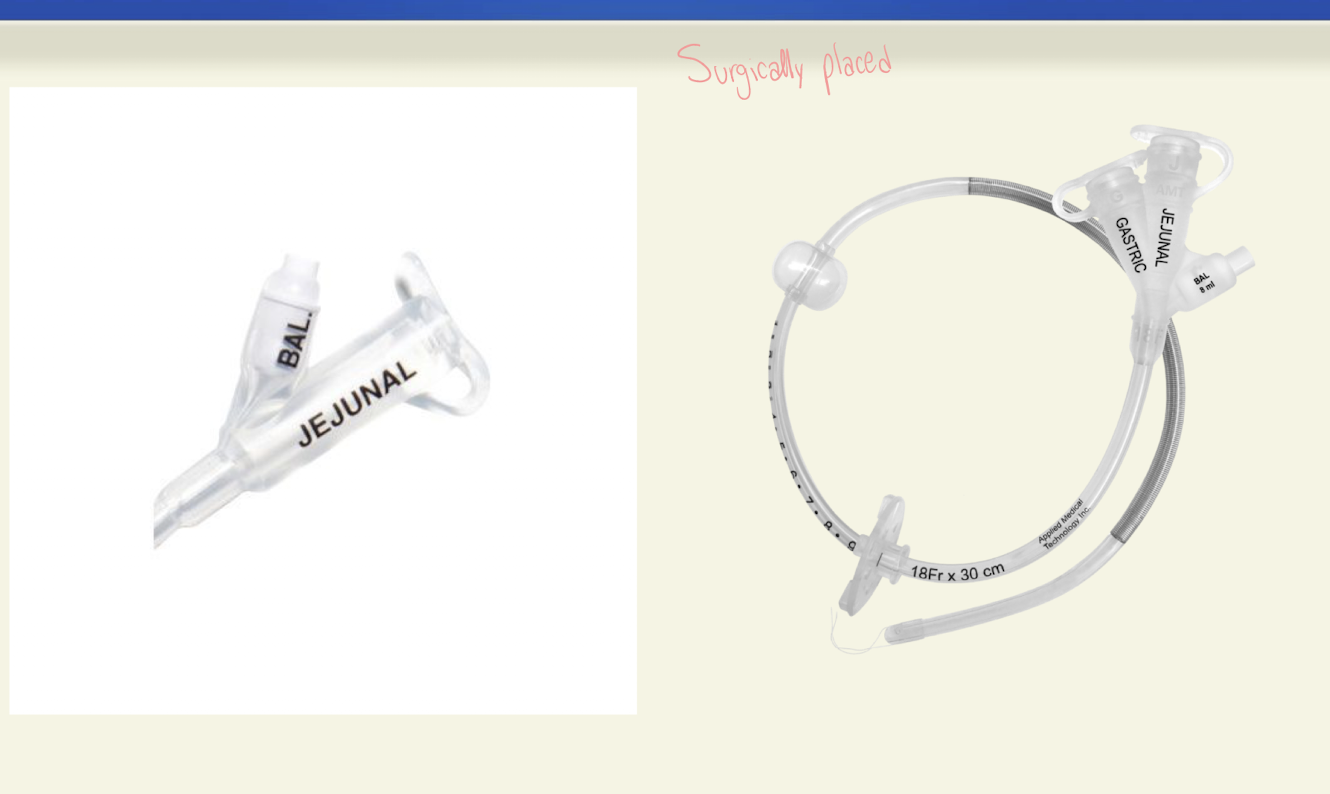 <p>-Gastric port for meds</p><p>-J port for feedings</p><p>-Gastric port may be attached to no intermittent suction or gravity drainage </p>