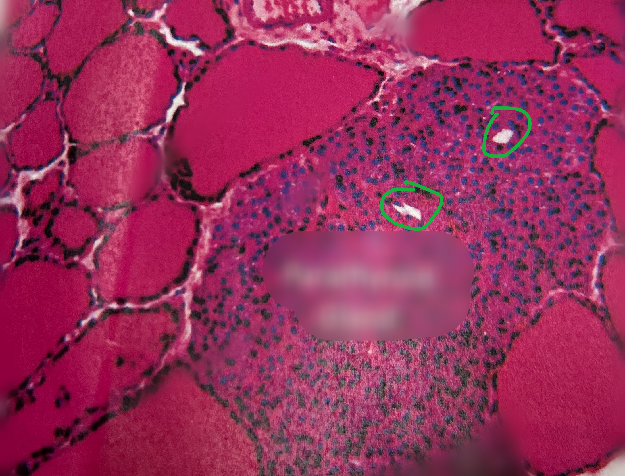 <p>What are the holes in the parathyroid gland known as?</p>