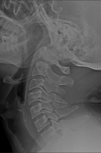 <p>What is the diagnosis?</p>