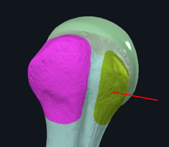 term image
